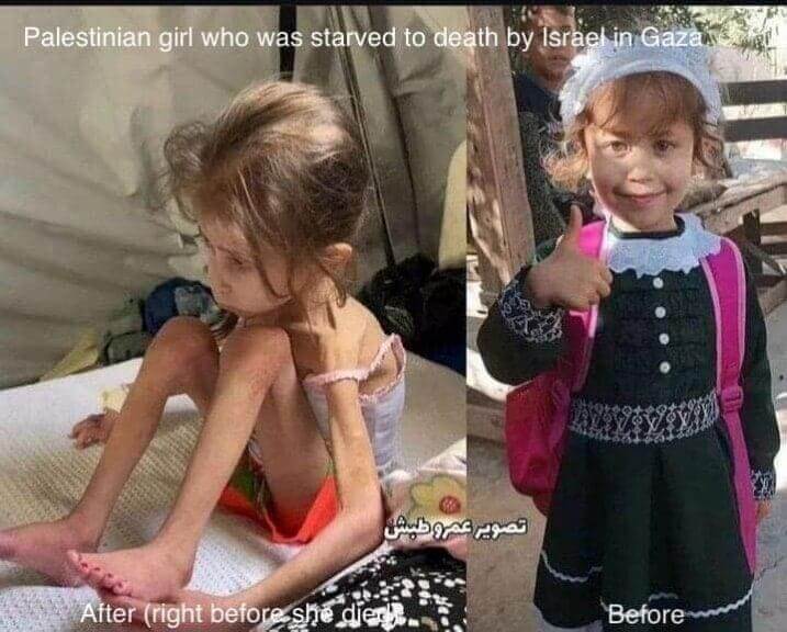 img 6312 Alittle girl suffering from malnutrition due to starvation in gaza.