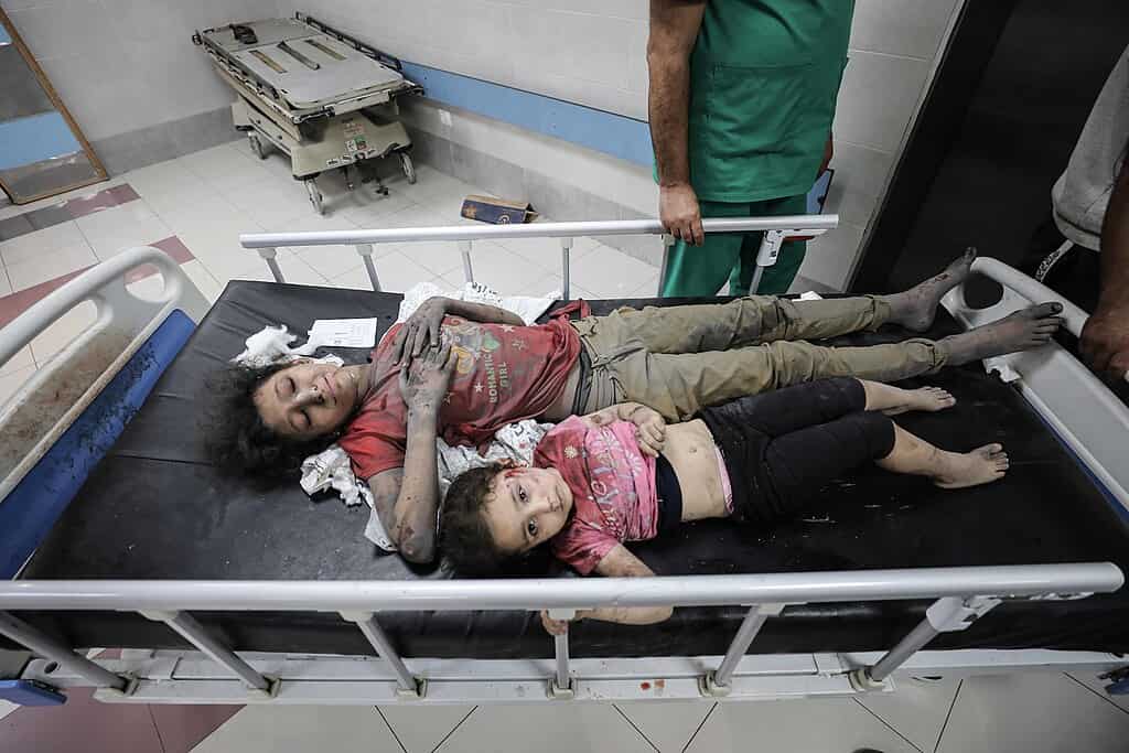 children gaza hospital Palestinian children await treatment at a hospital in gaza