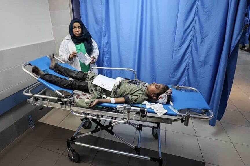 wounded child gaza Wounded child in gaza hospital