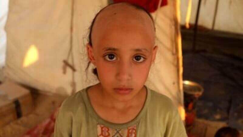 Video cover of gaza child who lost her hair from the stress of war refuseniks refuse to kill more children