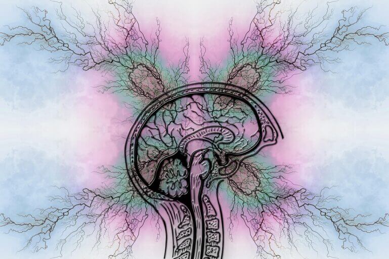symptoms of havana syndrome Colorful drawing of a brain experiencing an attack causing havana syndrome