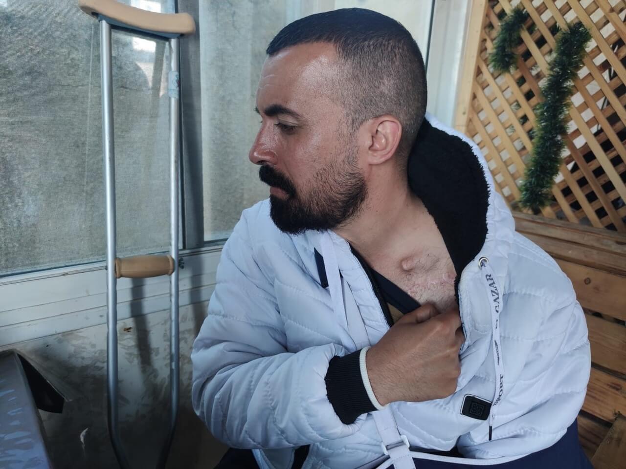 One of the victims of torture in israeli prisons