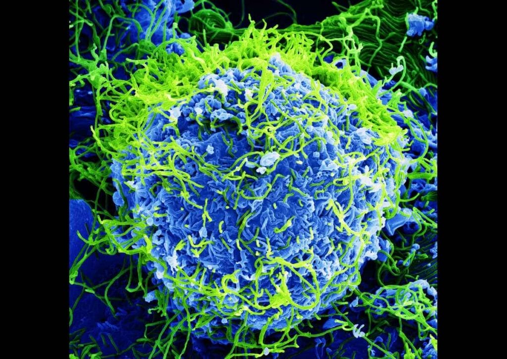 ebola virus Magnified view of the ebola virus. Cuts to usaid and the cdc