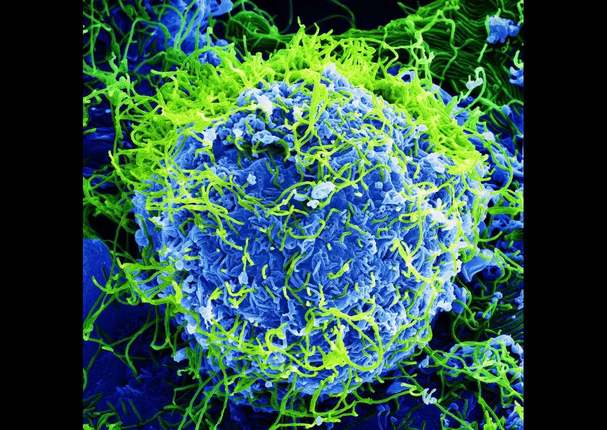 Magnified view of the ebola virus