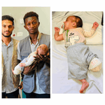 One of the children in gaza who are now amputees is a baby