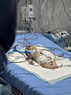 A baby in the