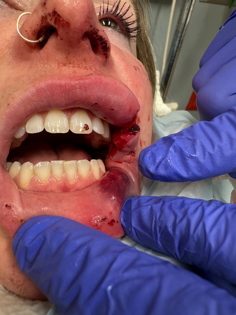 MGM Grand Detroit hate crime victim after the assault.