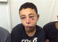 15-year-old who was brutally beaten by Israeli soldiers then imprisoned for months because he was “throwing stones.”