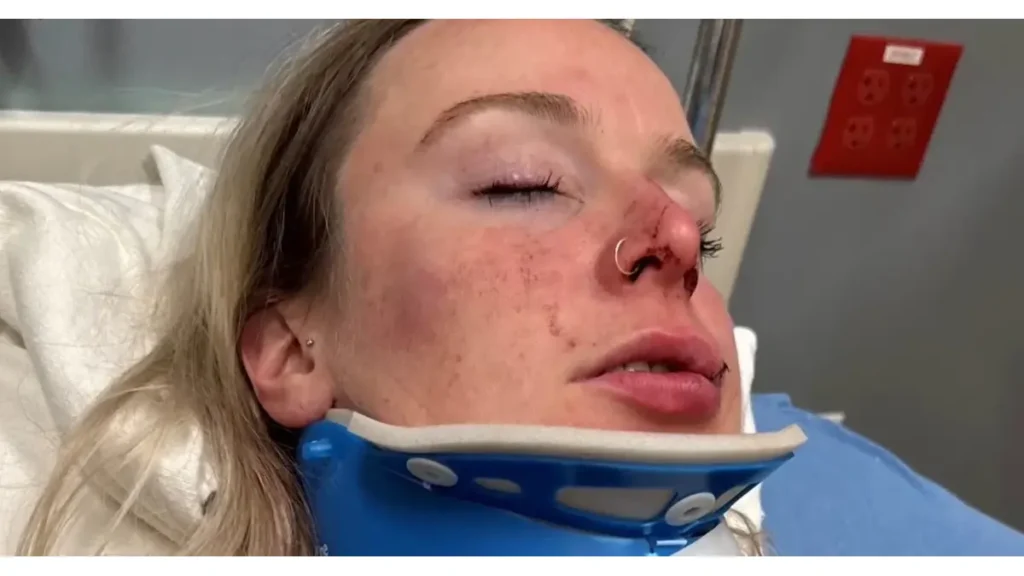 Celia in the hospital after she was attacked at mgm grand detroit casino
