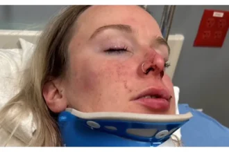 Celia in the hospital after she was attacked at mgm grand detroit casino
