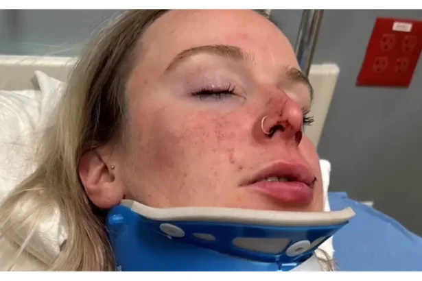 Celia in the hospital after she was attacked at MGM Grand Detroit casino